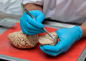Hände mit blauen Handschuhen und Gehirn, Institut für Anatomie der Uniklinik Rostock. 