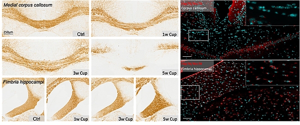 Anti-PLP immunohistochemistry reveals pronounced demyelination in vulnerable regions