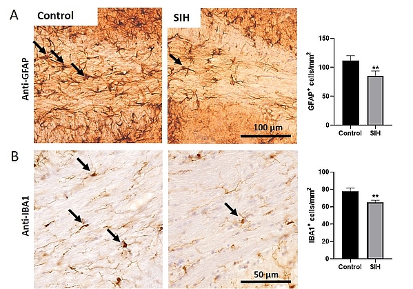 Chronic starvation leads to decreased astrocyte and microglia cell density in the corpus callosum.