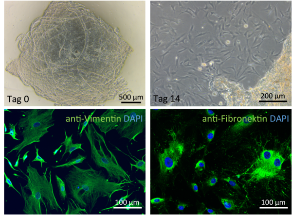 Primary human leptomeningeal fibroblasts 