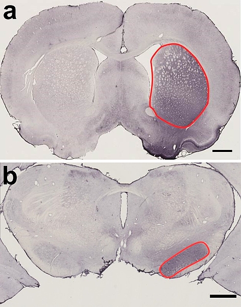 Auf dem Bild sind Schnitte durch das Gehirn einer Ratte zu sehen, die auf der rechten Seite mit Botulinumneurotoxin-A behandelt worden ist. 