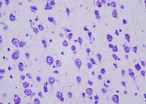 Paraffin section of the murine brain 