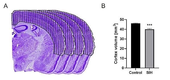 Chronic starvation leads to a reduction in cerebral cortex volume