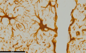 perivaskulärer Astrozyt im histologischem Schnitt