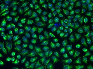 Cellculture of cancercells